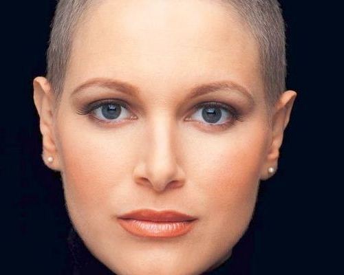 سرطان الثدي يغيّب ملكة جمال فنزويلا إيفا ايكفال عن 28 عاماً