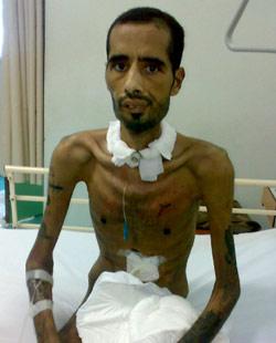  انخفض وزن محمد إلى النصف بعد الحادثة