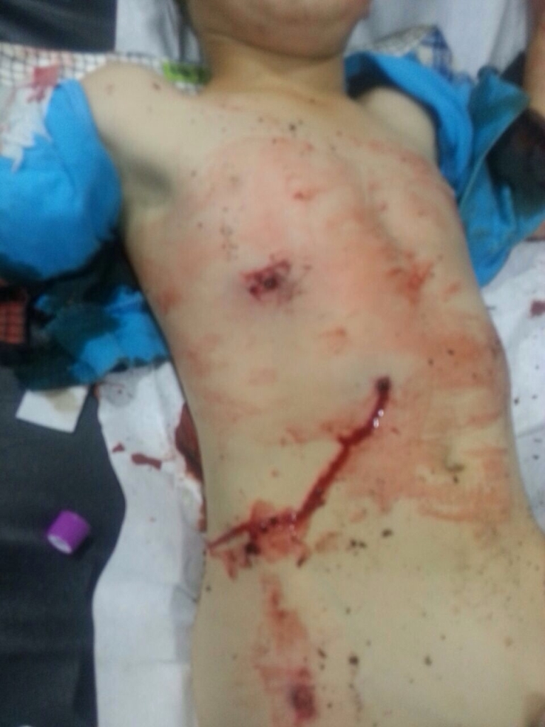 أحد الاطفال الجرحى في مستشفى تبنين