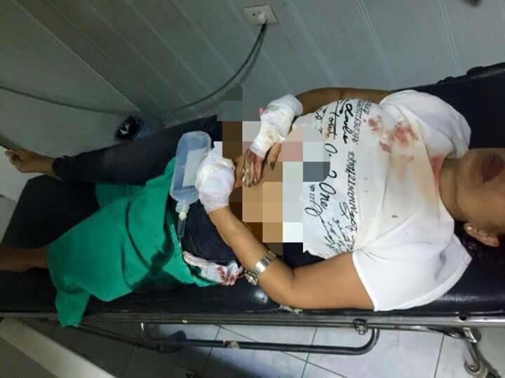 فاطمة مسعود عقب تعرضها لإطلاق النار إثر شجار عائلي 2015