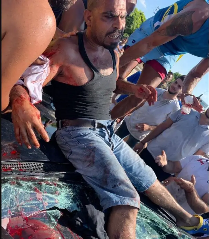 دهسُ أحد المحتجين على أوتوستراد الغازية وإصابته خطرة!