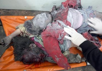 سقط حتى الآن اكثر من 415 شهيد والفي جريح ودمّر العدوان مئات البيوت