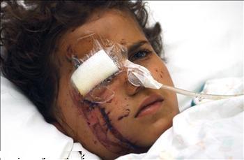 هويدا خالد يوم إجراء العملية