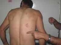 آثار كدمات على جسده