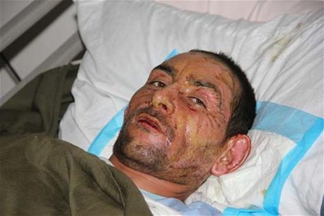 المآسي تلاحق النازحين السوريين إلى لبنان