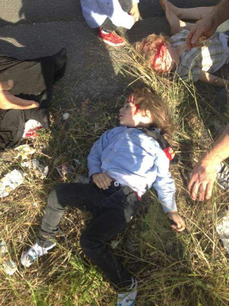 بعض الأطفال المصابين