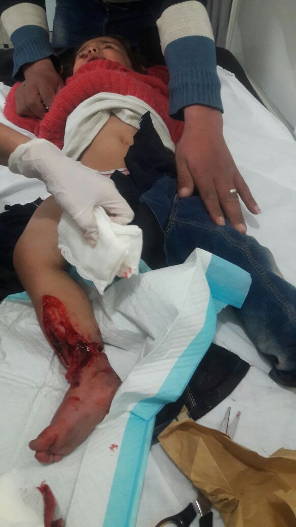 حميدة  بعد الحادث