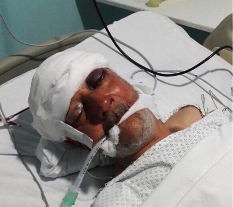 الأب في المستشفى